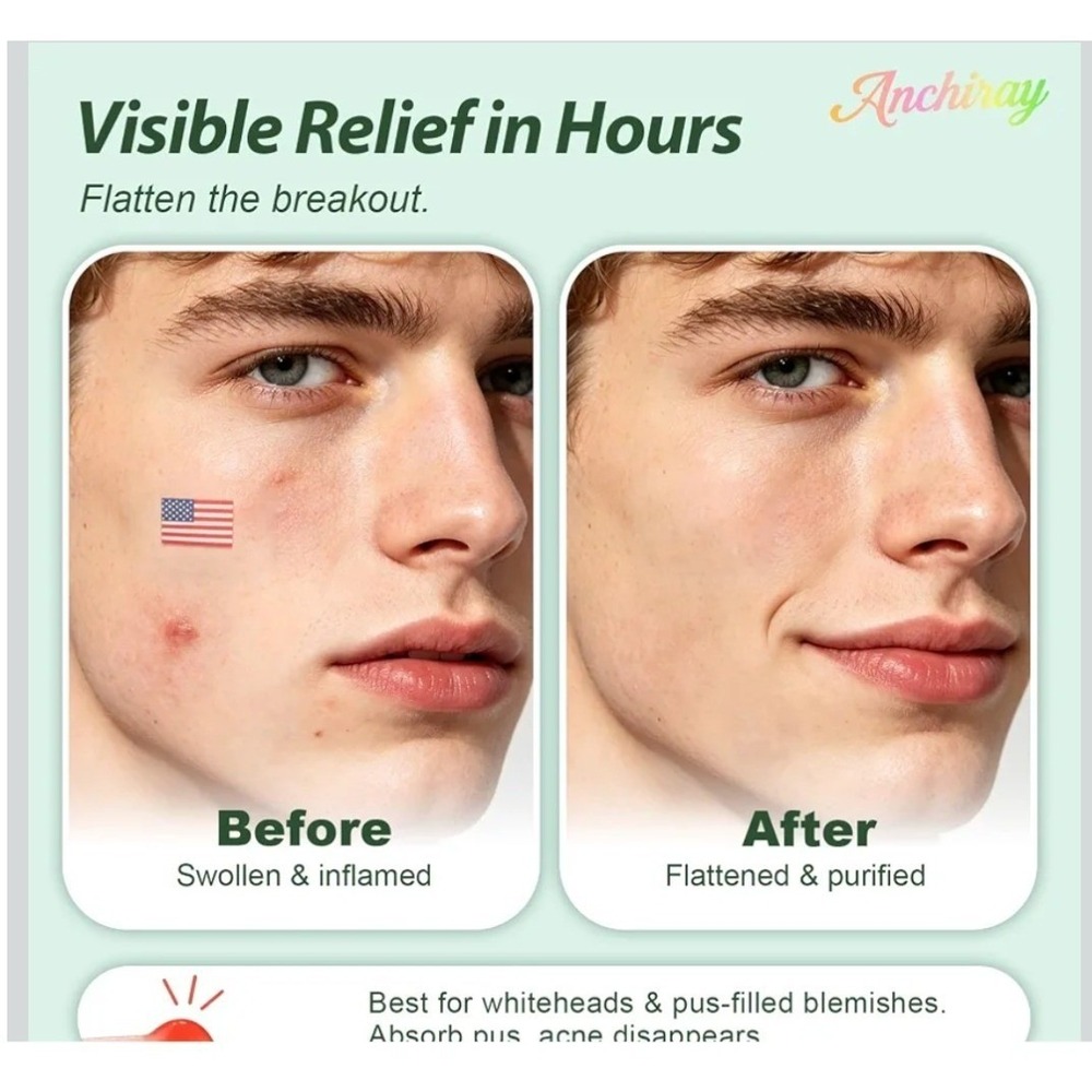 Anchiray Professional Hydrocolloid Pimple Patch 80 Count Sports & Flag Designs - Picture 6 of 7